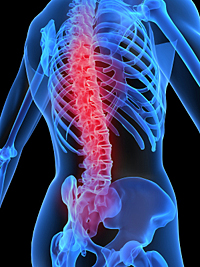 Back pain x-ray