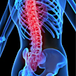 Back pain x-ray