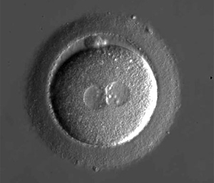 Human embryo under microscope