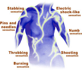 Patrick McHugh - neuropathic pain