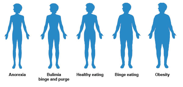 Eating disorder illustration