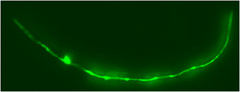 Worm with fluorescent protein expression in the excretory canal (ie the worm kidney in green)