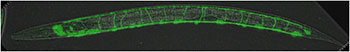 One worm with the nervous system marked with green fluorescent protein. 