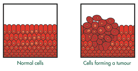 Cells mutating into a tumour